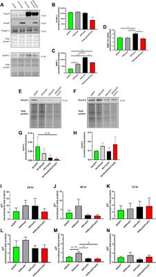 FoxO3 normalizes Smad3-induced arterial smooth muscle cell growth